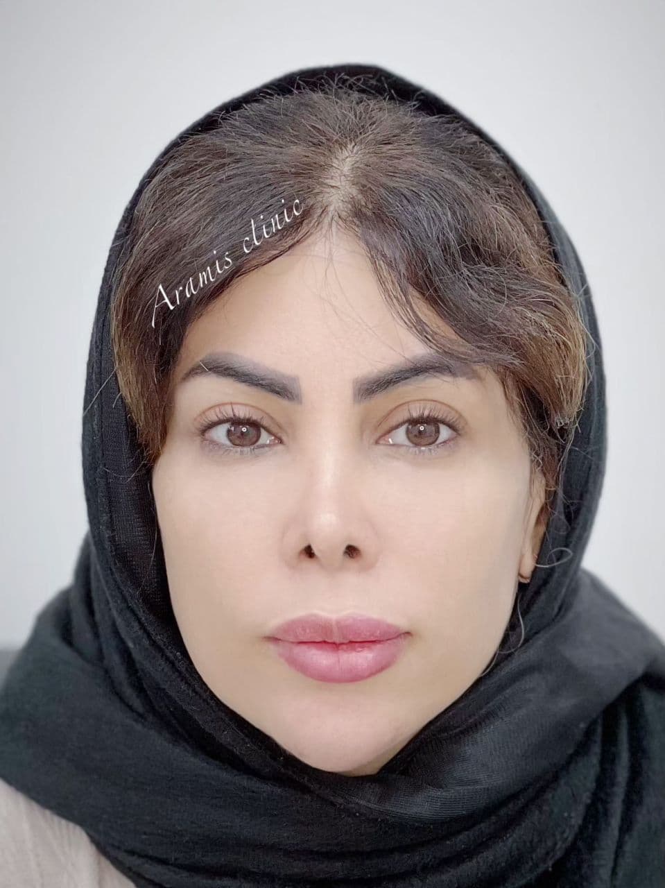 قبل - 1