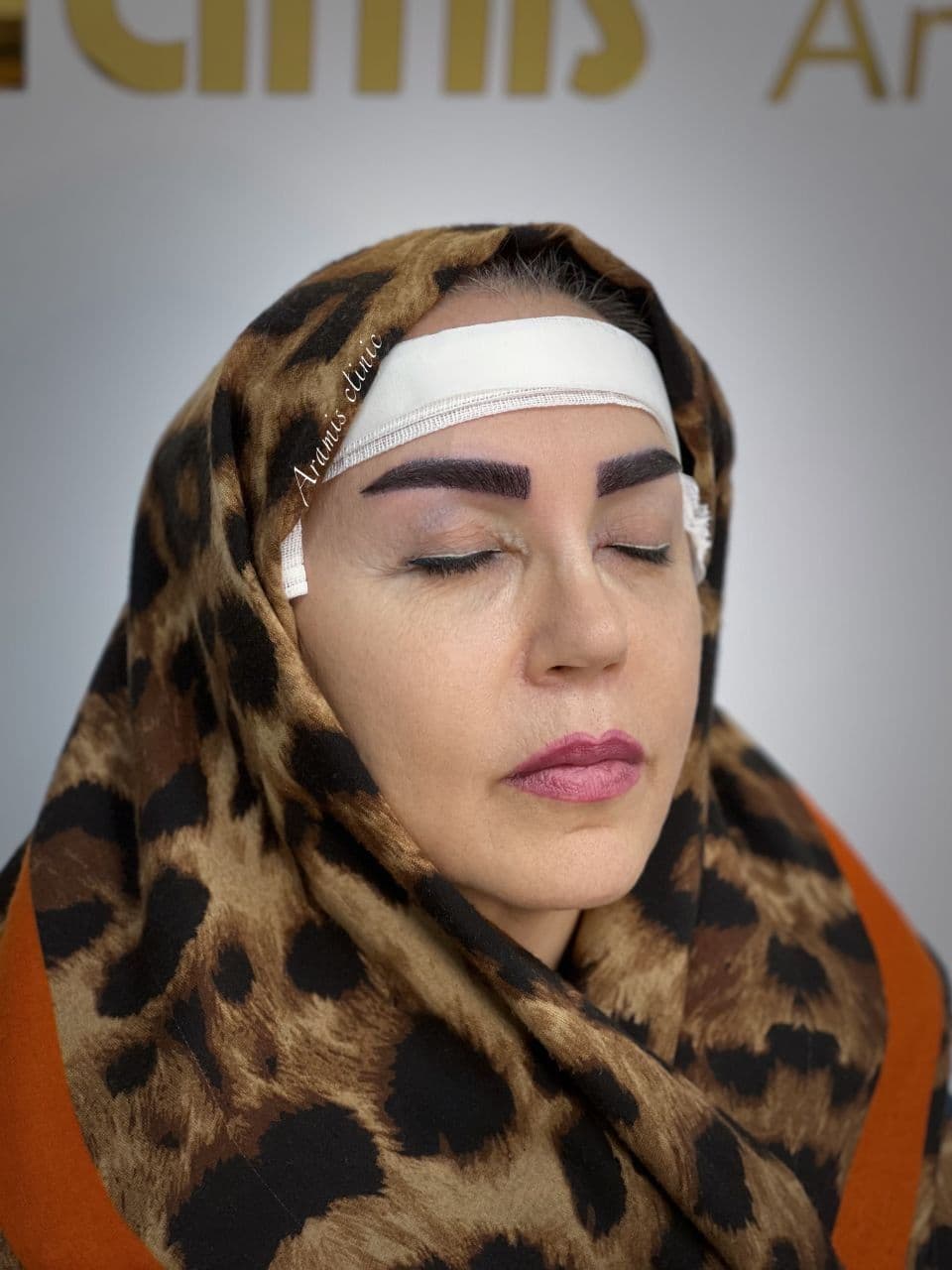 بعد - 3