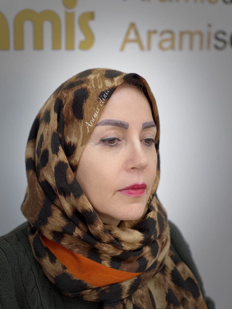 قبل - 3