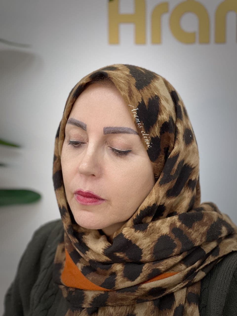 قبل - 2