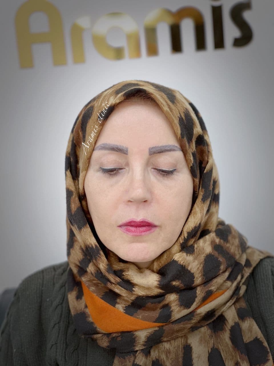 قبل - 1