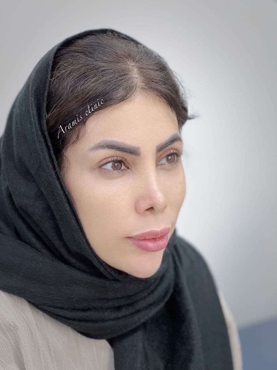 قبل - 2