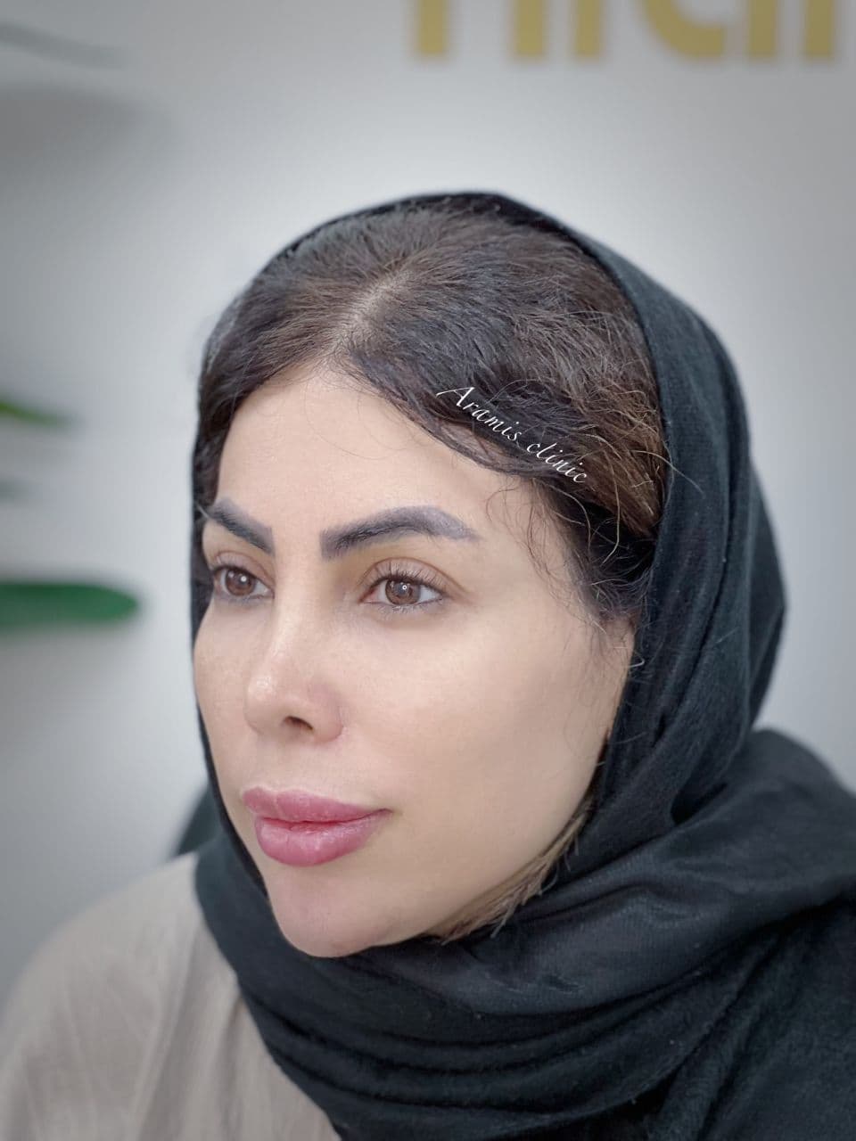 قبل - 3