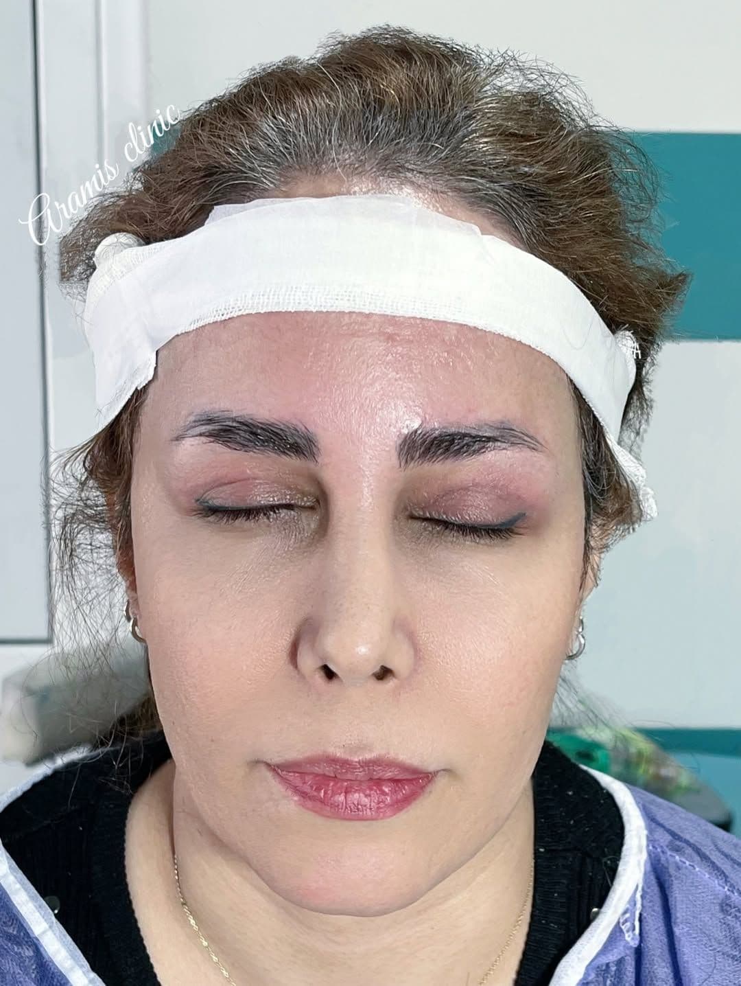 قبل - 1