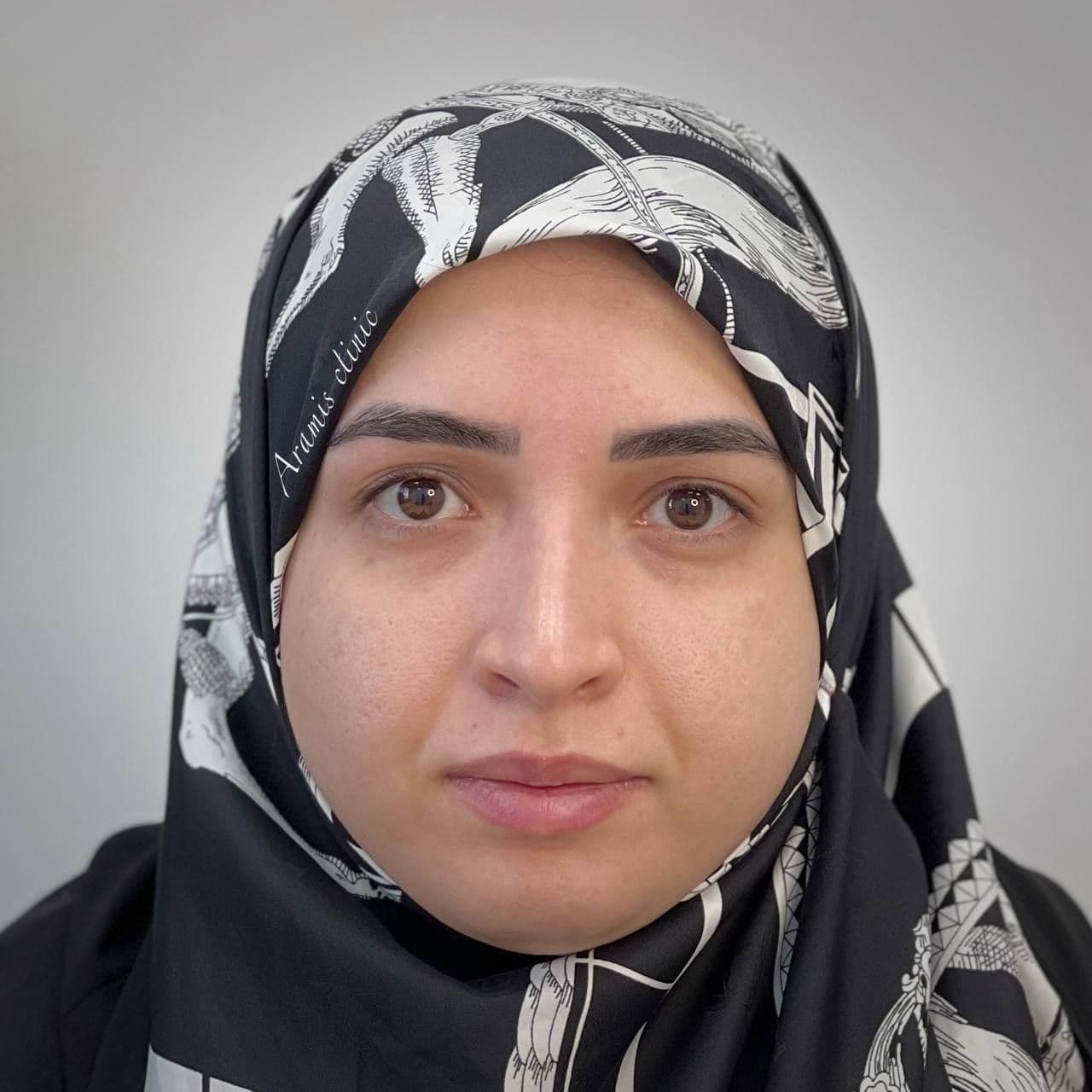 قبل - 1