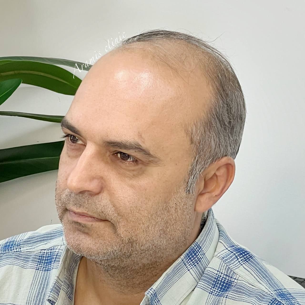 قبل - 1