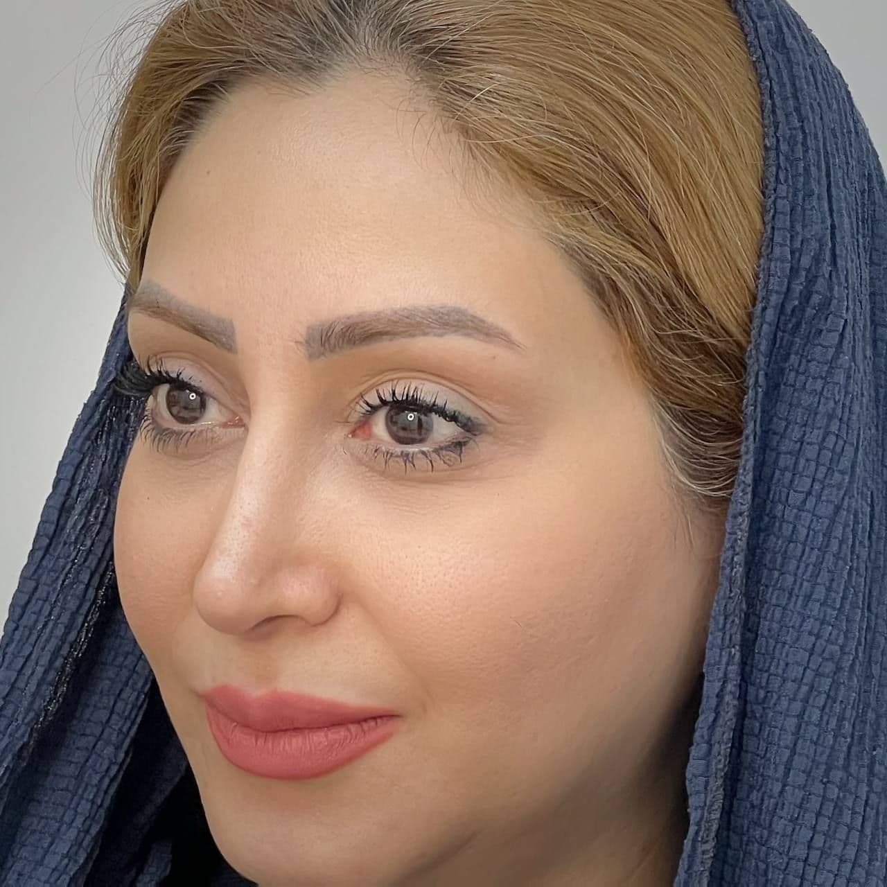 قبل - 3