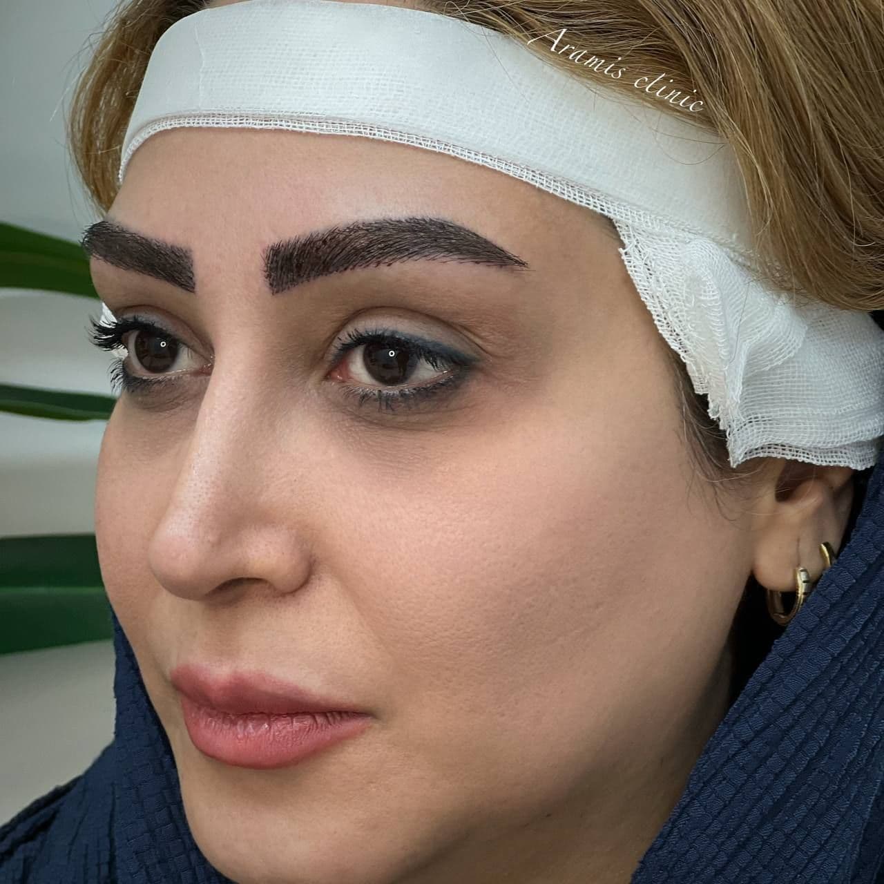 بعد - 3