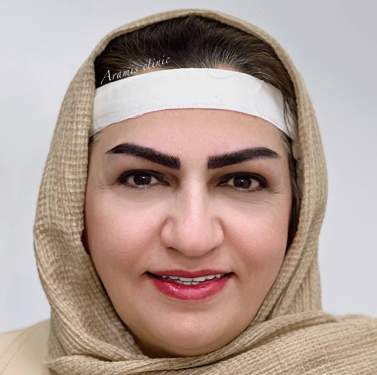 بعد - 2