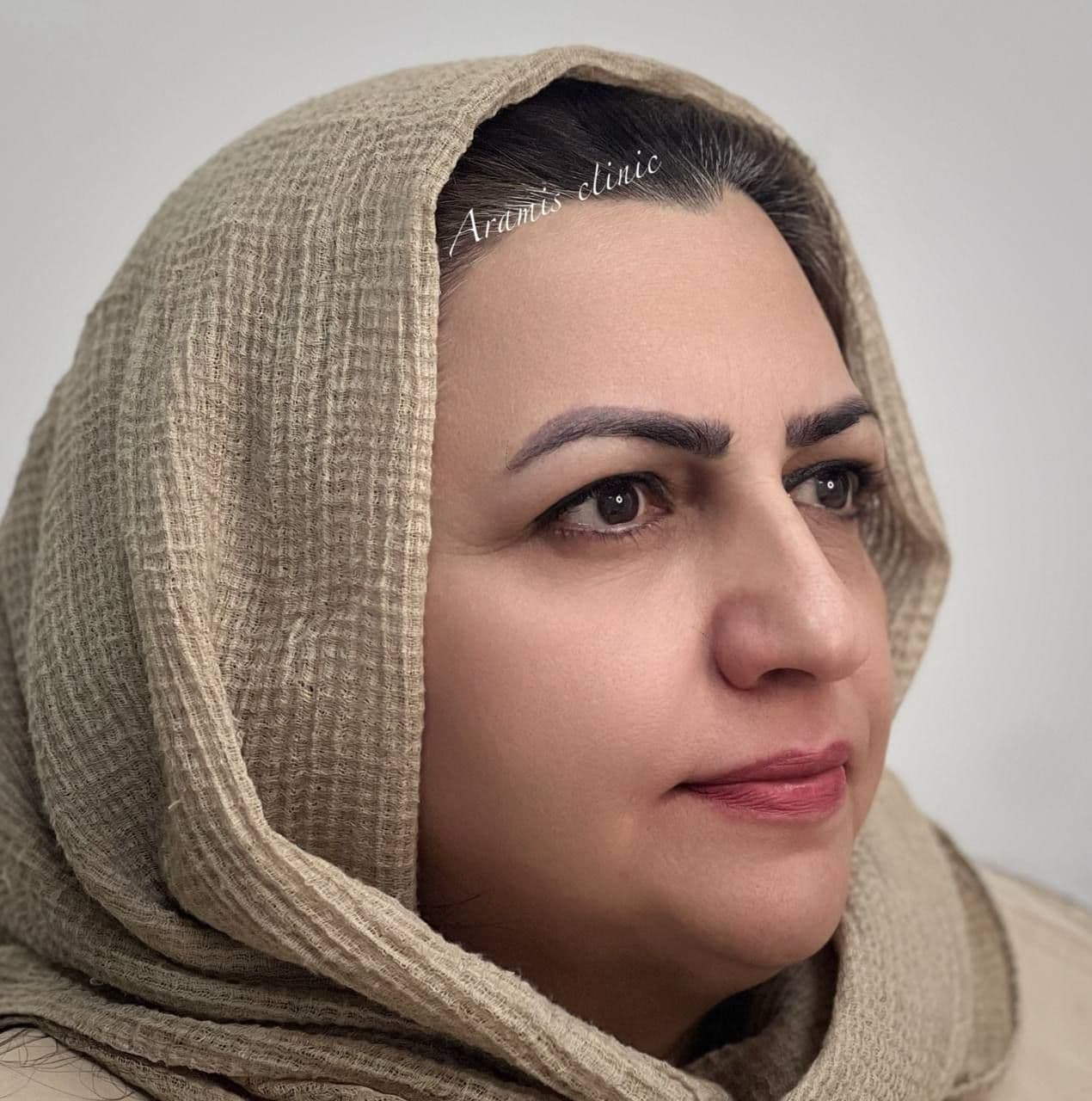 قبل - 3